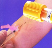 Vacutainer