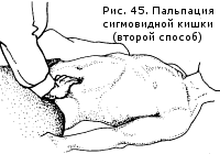    ( )